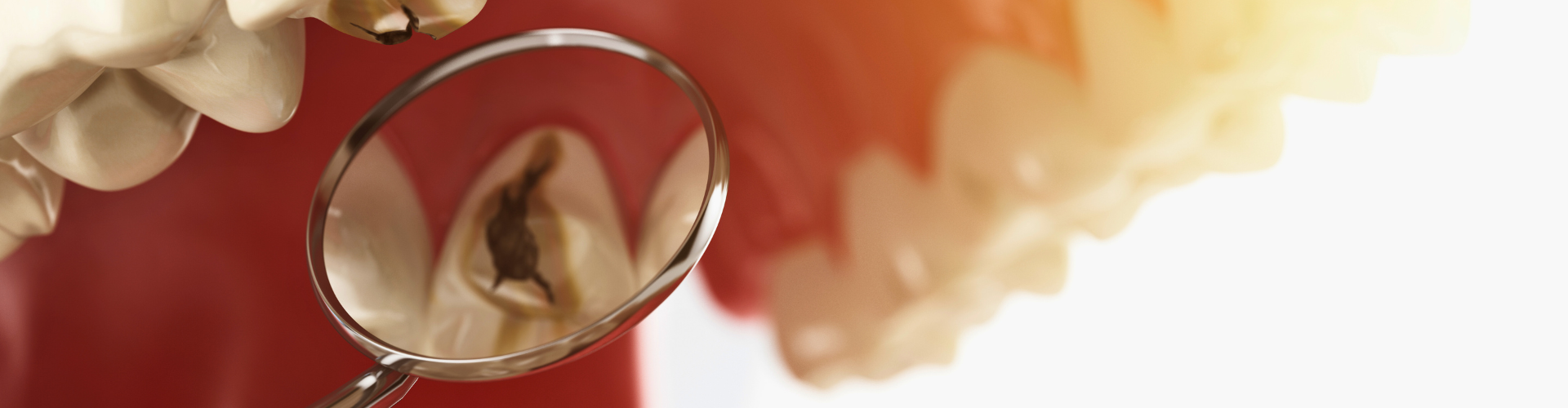 Rendering of a dental mirror reflecting a tooth cavity.